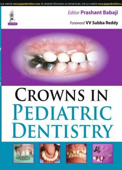 CROWNS IN PEDIATRIC DENTISTRY