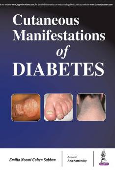 CUTANEOUS MANIFESTATIONS OF DIABETIES