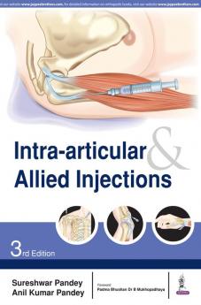 Intra-articular & Allied Injections