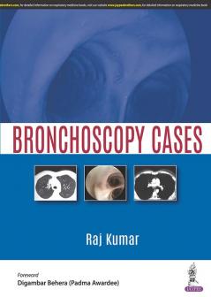 Bronchoscopy Cases