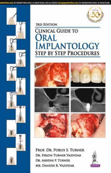 CLINICAL GUIDE TO ORAL IMPLANTOLOGY:STEP BY STEP PROCEDURES