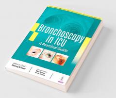 BRONCHOSCOPY IN ICU: A PRACTICAL GUIDE