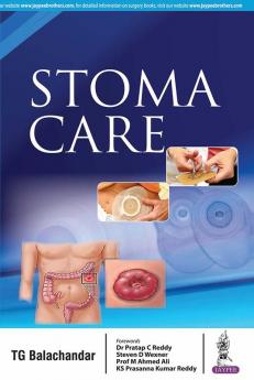 STOMA CARE