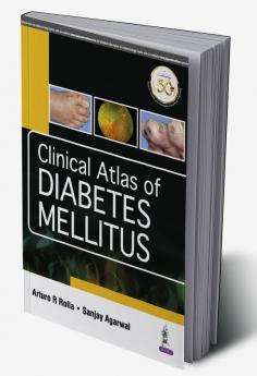 Clinical Atlas of Diabetes Mellitus