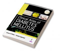 Clinical Atlas of Diabetes Mellitus