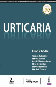 URTICARIA