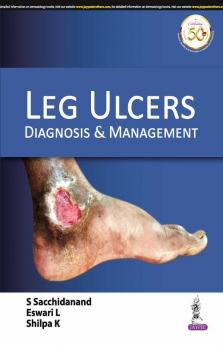 LEG ULCERS: DIAGNOSIS & MANAGEMENT 1st end