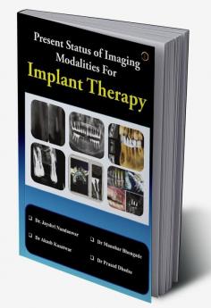 Present Status of Imaging Modalities For Implant Therapy