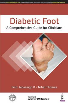 Diabetic Foot: A Comprehensive Guide for Clinicians