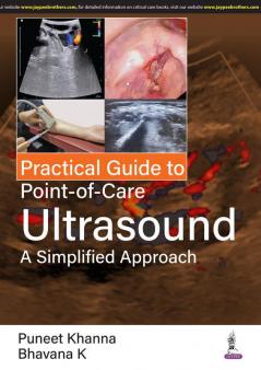 Practical Guide to Point-of-Care Ultrasound: A Simplified Approach