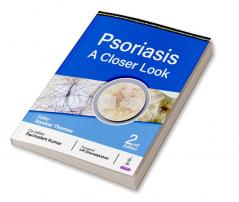 PSORIASIS: A CLOSER LOOK