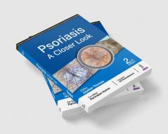 PSORIASIS: A CLOSER LOOK