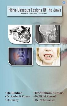 Fibro Osseus Lesion Of The Jaw