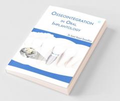 Osseointegration In Oral Implantology