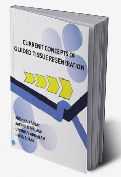 CURRENT CONCEPTS OF GUIDED TISSUE REGENERATION