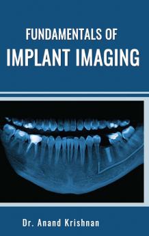 FUNDAMENTALS OF IMPLANT IMAGING