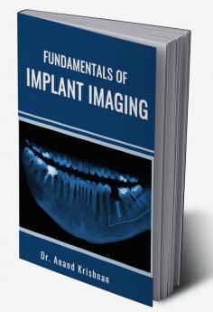 FUNDAMENTALS OF IMPLANT IMAGING