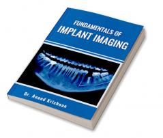 FUNDAMENTALS OF IMPLANT IMAGING