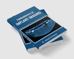 FUNDAMENTALS OF IMPLANT IMAGING