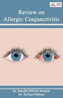 Review on Allergic Conjunctivitis