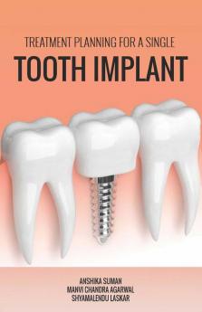 TREATMENT PLANNING FOR A SINGLE TOOTH IMPLANT