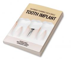 TREATMENT PLANNING FOR A SINGLE TOOTH IMPLANT