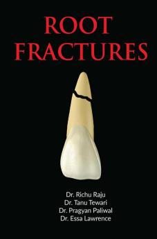 ROOT FRACTURE