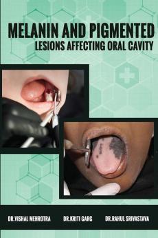 Melanin and Pigmented Lesions Affecting Oral Cavity