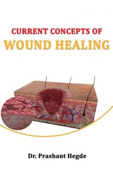 Current Concepts Of Wound Healing