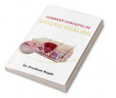 Current Concepts Of Wound Healing