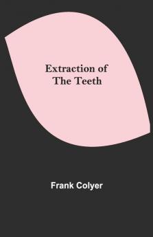Extraction Of The Teeth