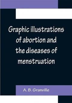 Graphic illustrations of abortion and the diseases of menstruation; Consisting of Twelve Plates from Drawings Engraved on Stone and Coloured by Mr. J. Perry and Two Copper-plates from the Philosophical Transactions Coloured by the Same Artist. the Whole Representing Forty-five Specimens of Aborted Ova and Adventitious Productions of the Uterus With Preliminary Observations Explanations of the Figures and Remarks Anatomical and Physiological.