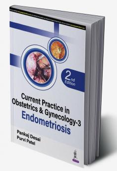 Current Practice in Obstetrics & Gynecology-3 Endometriosis