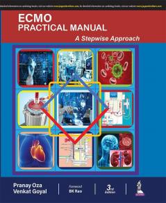 ECMO Practical Manual: A Stepwise Approach