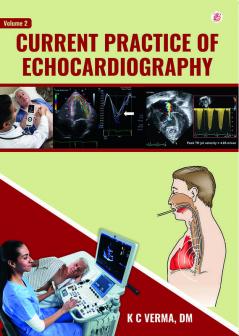 Current Practice Of Echocardiography | Volume 2