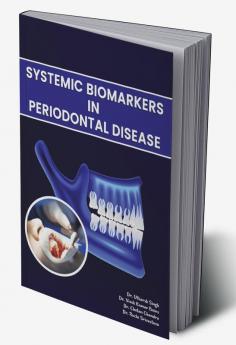 Systemic Biomarkers In Periodontal Disease