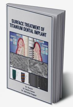 SURFACE TREATMENT OF TITANIUM DENTAL IMPLANT