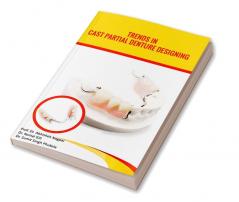 Trends in Cast Partial Denture Designing