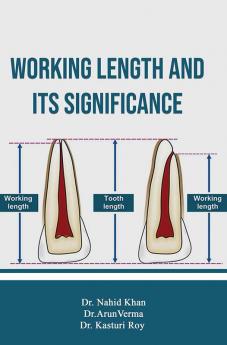 Working Length and Its Significance