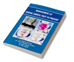 Management Of Dental Caries: Past To Present