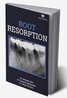 Root Resorption