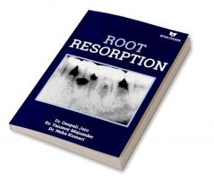 Root Resorption