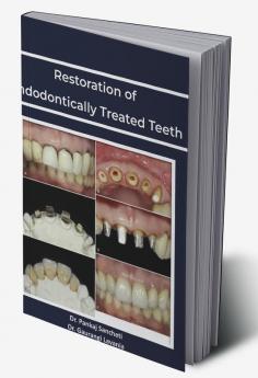 Nerve Injuries of Maxillofacial Region