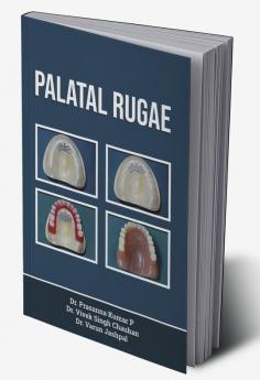 Palatal Rugae