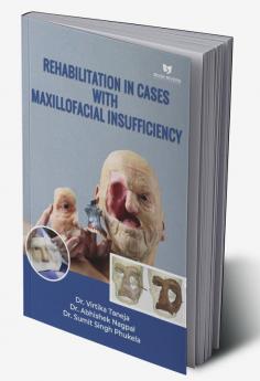 Rehabilitation In Cases With Maxillofacial Insufficiency