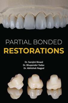 Partial Bonded Restorations