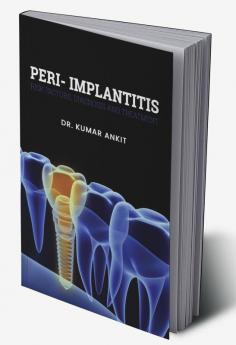 Peri-Implantitis:  Risk Factors Diagnosis And Treatment