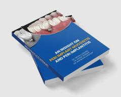 Peri Implant Mucositis And Peri Implantitis