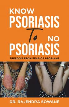Know Psoriasis To No Psoriasis: Freedom from Fear of Psoriasis