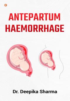 Antepartum Haemorrhage